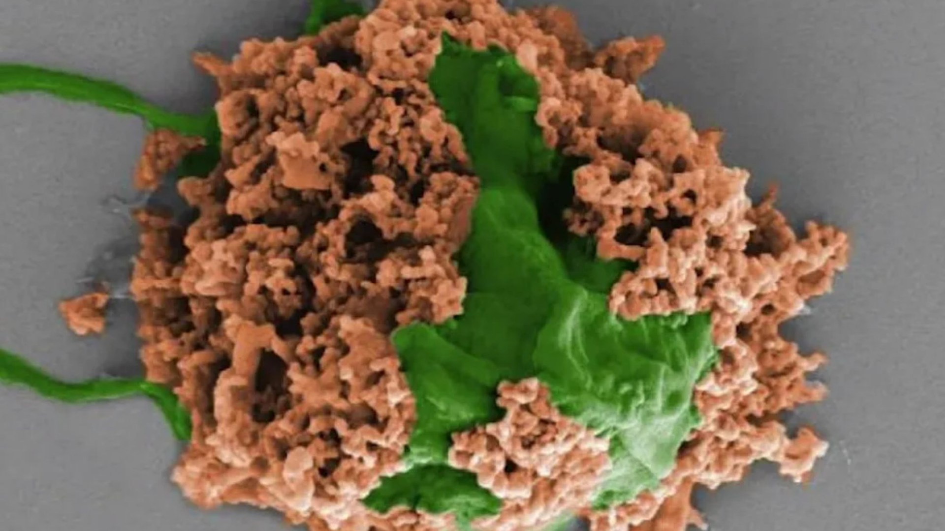 Tiny microrobots made from ‘pond scum’ could shrink lung cancer tumours and boost survival by 40%, scientists say