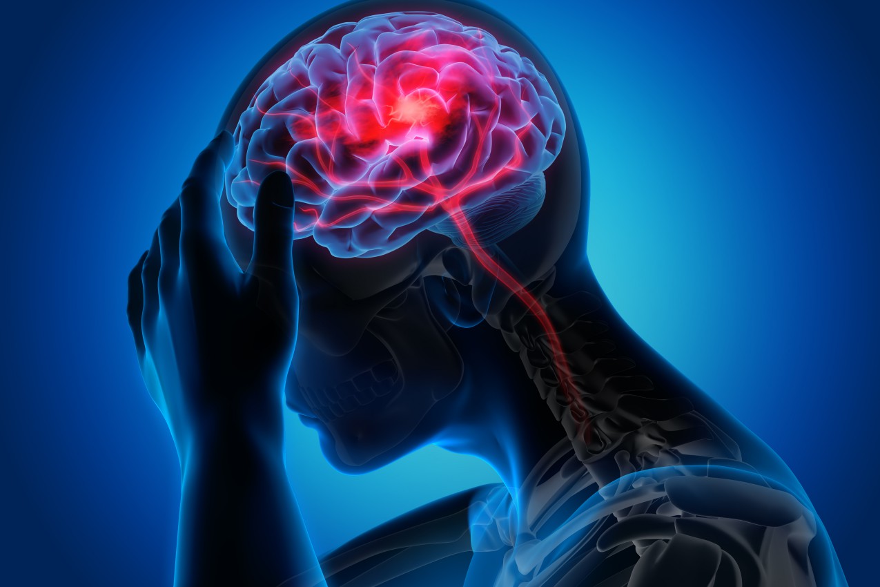 What causes a stroke and what are the main symptoms to look out for? – The Sun