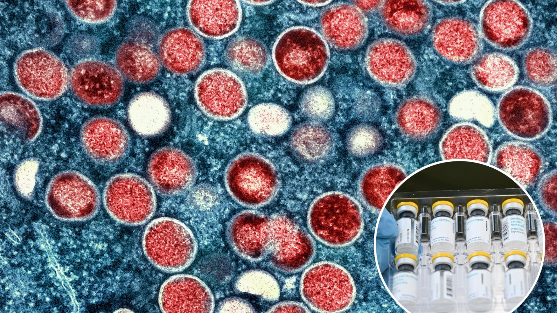 UK preparing for worst-case mpox scenario, officials warn – as vaccines stockpiled amid global surge of killer strain