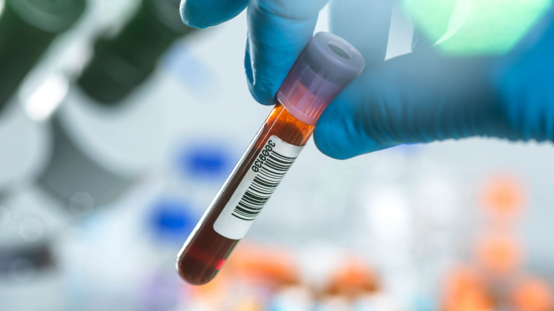 Breakthrough blood test could detect early stages of Alzheimer’s YEARS before symptoms show