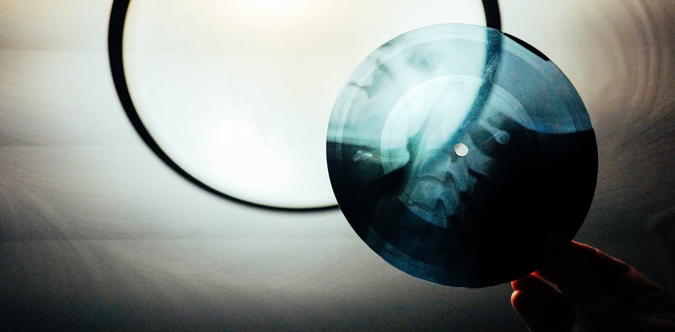 When Elvis and Ella were pressed onto X-rays – the subversive legacy of Soviet ‘bone music’